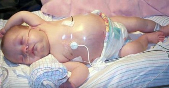 Legen ser at noe vokser i babyens mage. Etter en nærmere undersøkelse ser han det samme hos tvillingsøsteren også!